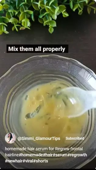 cara menumbuhkan rambut botak samping berbagai sumber