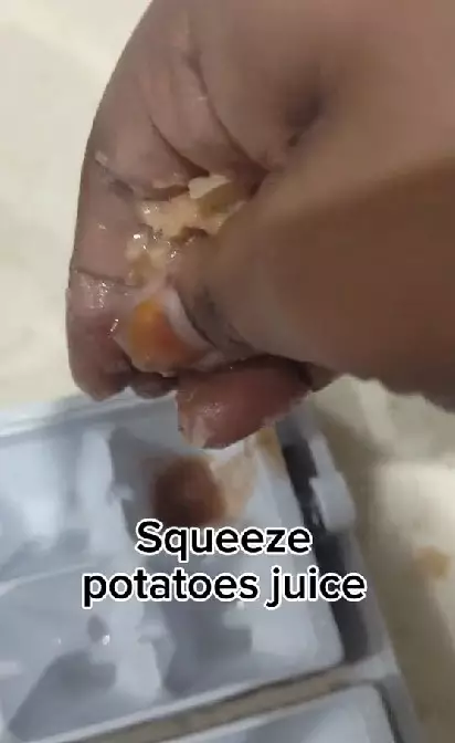 Kentang atasi flek hitam agar wajah cerah merata Berbagai sumber