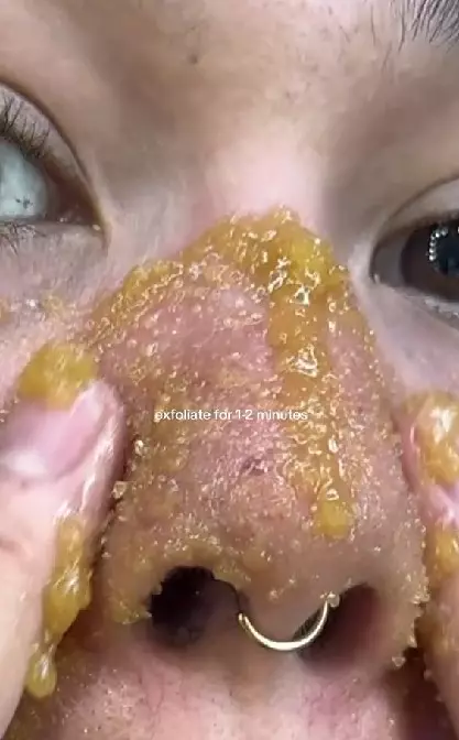 Beauty enthusiast bersihkan komedo di hidung TikTok
