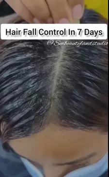 cara mengatasi rambut rontok berbagai sumber