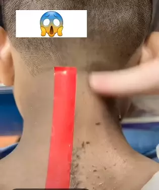 cara atasi leher hitam. berbagai sumber