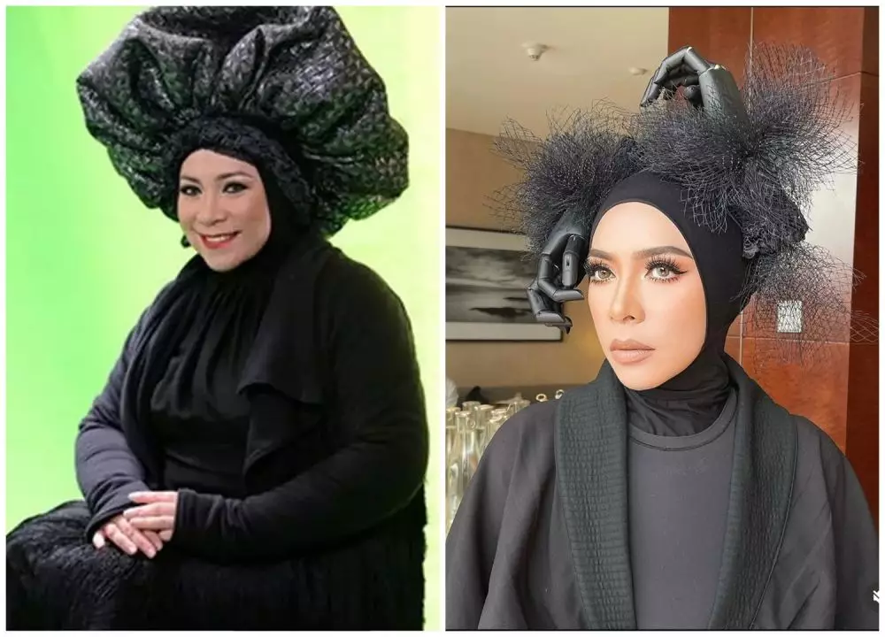 Potret sebelum dan sesudah 9 seleb sedot lemak berbagai sumber