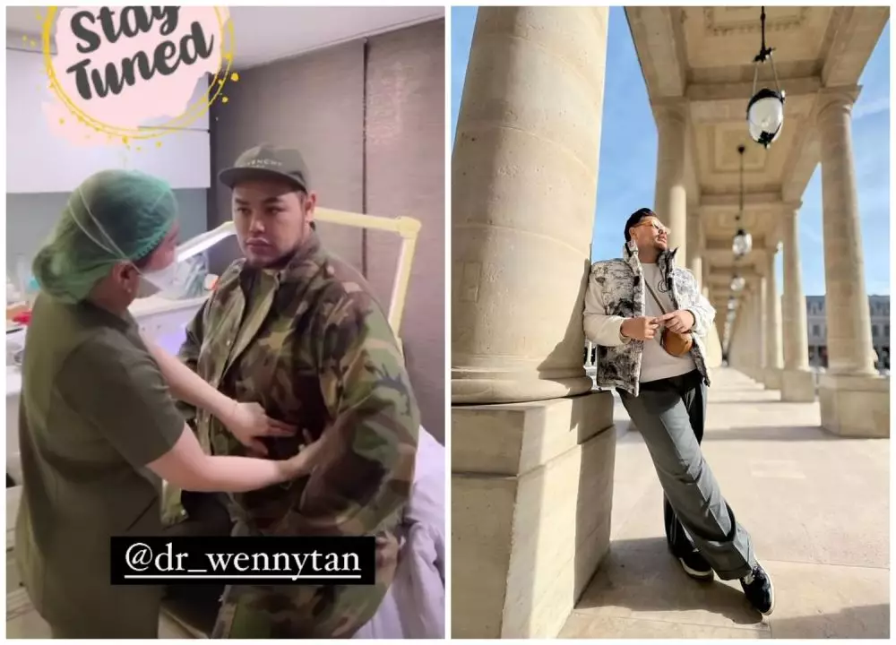 Potret sebelum dan sesudah 9 seleb sedot lemak berbagai sumber