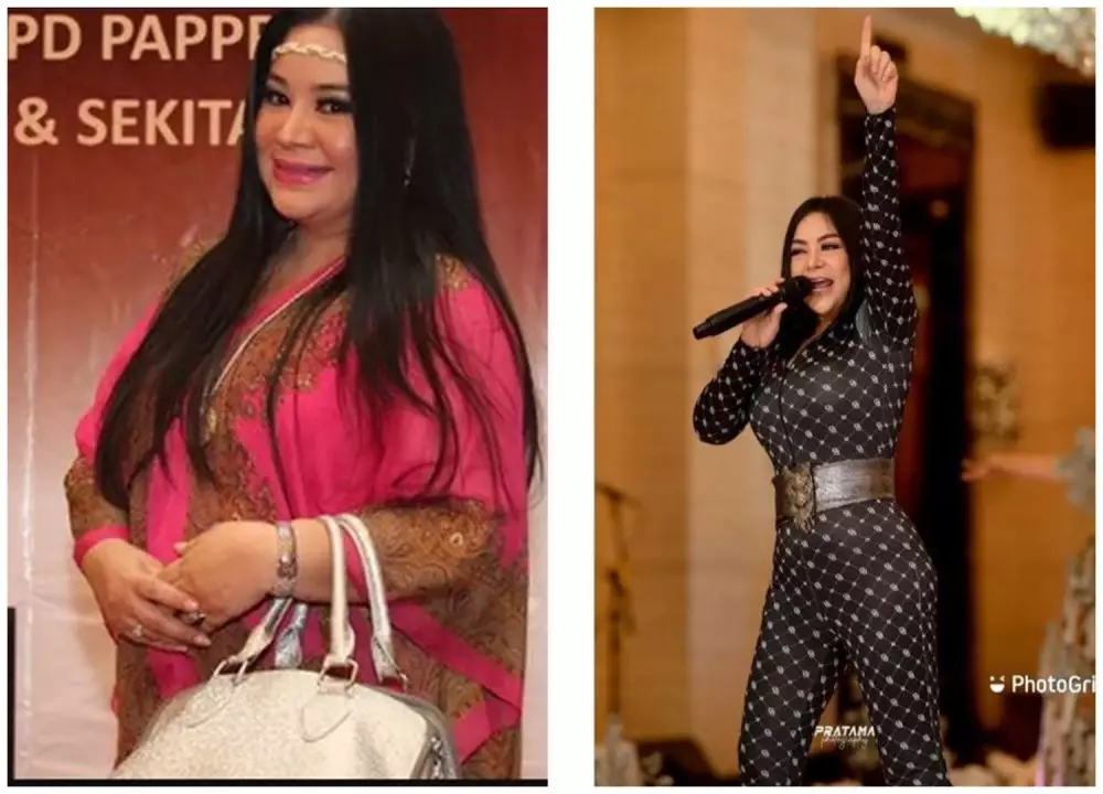 Potret sebelum dan sesudah 9 seleb sedot lemak berbagai sumber