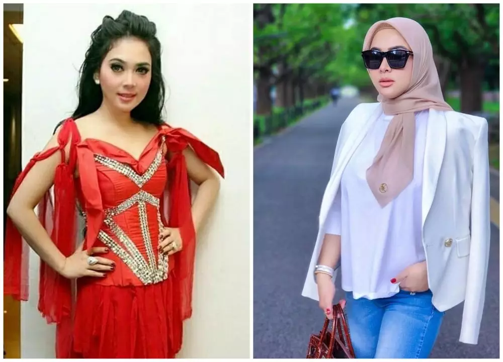 Potret sebelum dan sesudah 9 seleb sedot lemak berbagai sumber