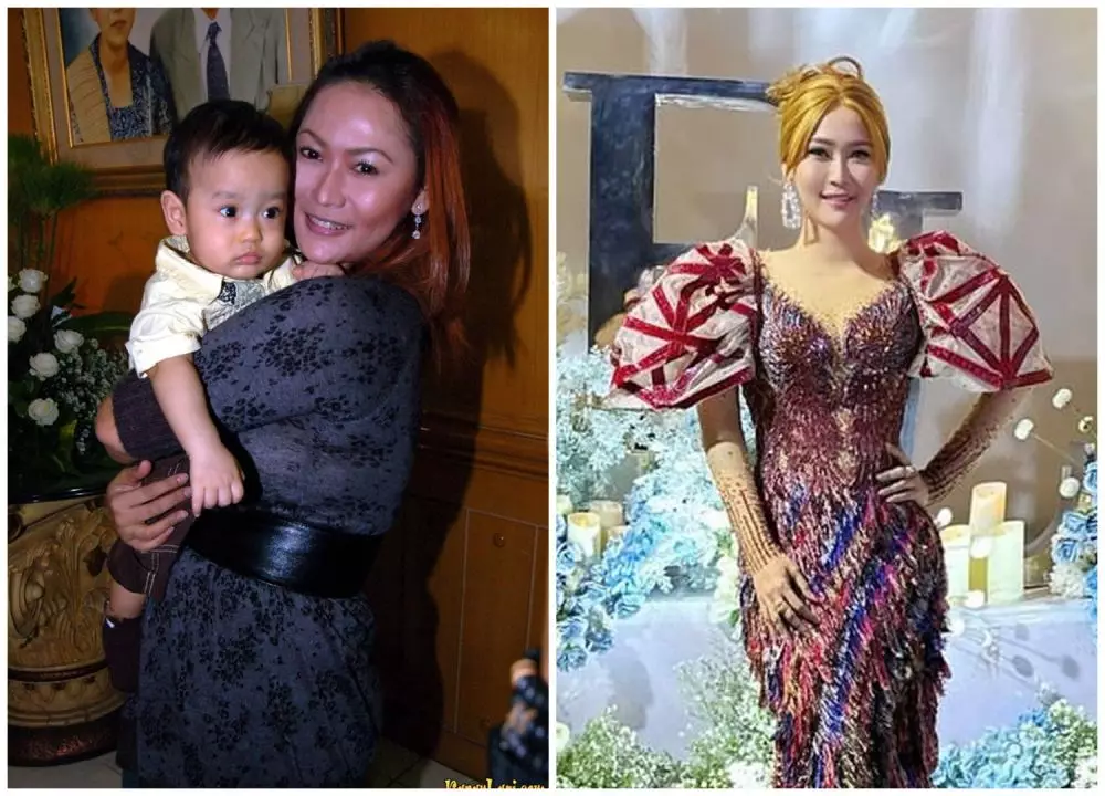 Potret sebelum dan sesudah 9 seleb sedot lemak berbagai sumber