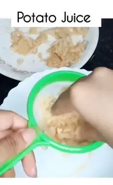 cara hilangkan flek hitam di pipi berbagai sumber cara hilangkan flek hitam di pipi berbagai sumber