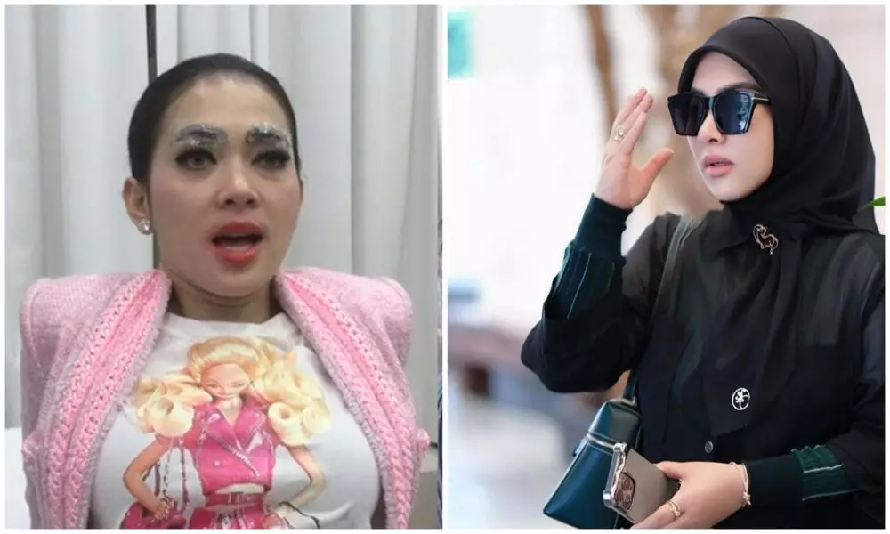 sebelum dan sesudah 9 seleb lakukan sulam bibir berbagai sumber