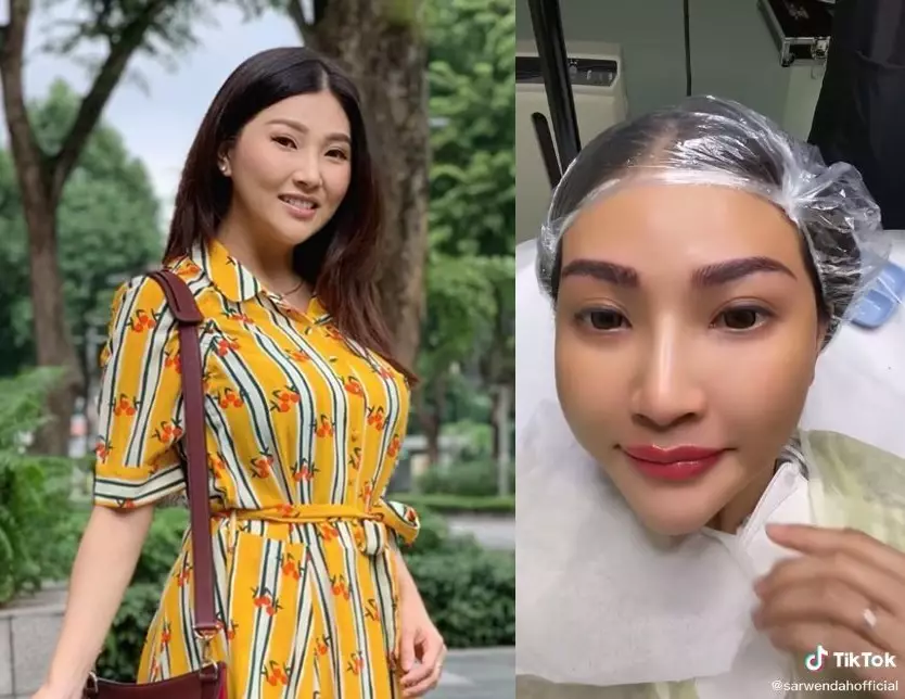 sebelum dan sesudah 9 seleb lakukan sulam bibir berbagai sumber