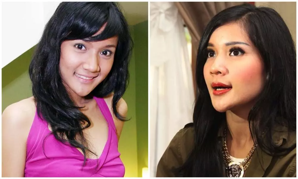 sebelum dan sesudah 9 seleb lakukan sulam bibir berbagai sumber