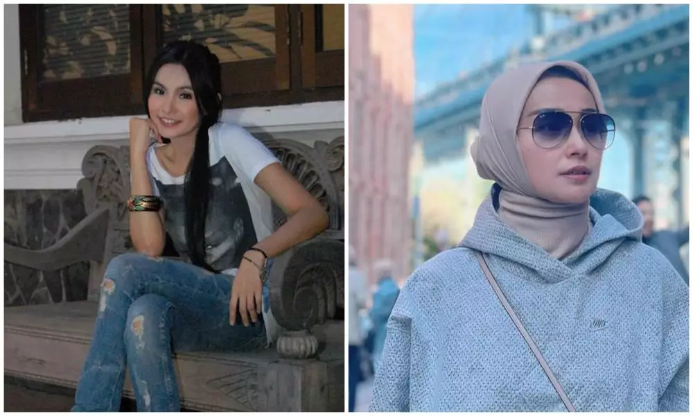 sebelum dan sesudah 9 seleb lakukan sulam bibir berbagai sumber