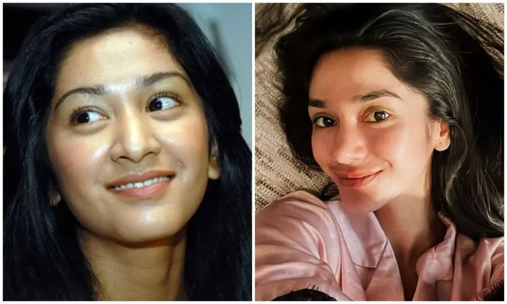 sebelum dan sesudah 9 seleb lakukan sulam bibir berbagai sumber