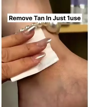 cara cerahkan mata kaki hitam berbagai sumber