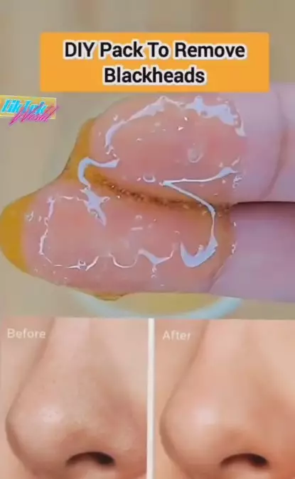 Hempas komedo di hidung pakai scrub 3 bahan alami TikTok