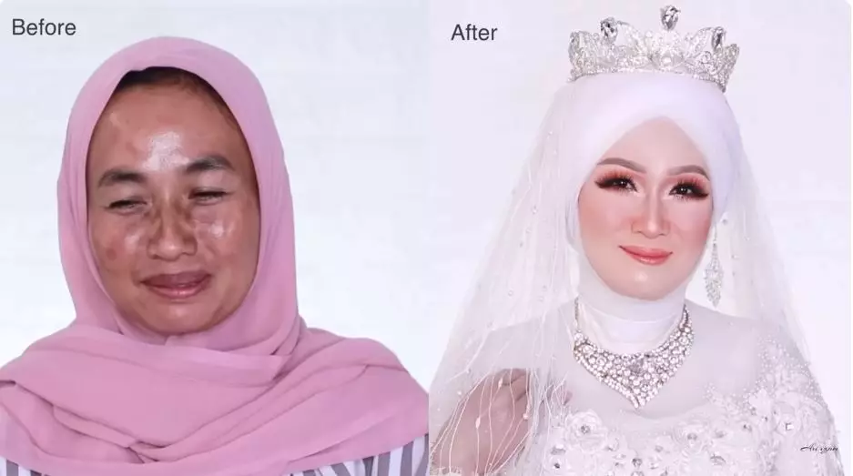 wajah nenek usia 50-an berflek hitam berbagai sumber