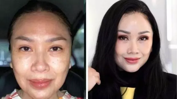 Seleb sebelum dan sesudah face lifting Berbagai sumber