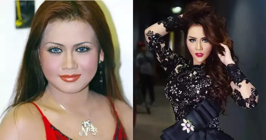 Seleb sebelum dan sesudah face lifting Berbagai sumber