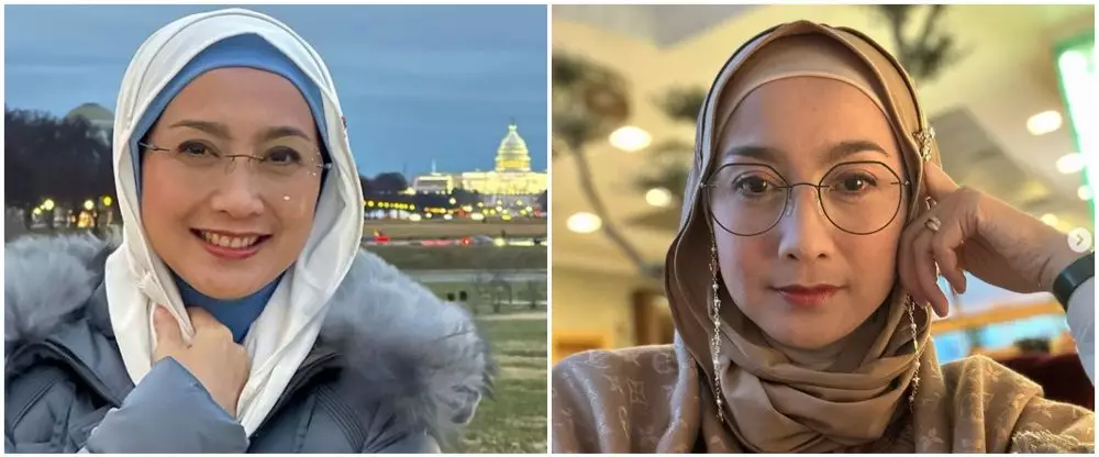 Seleb sebelum dan sesudah face lifting Berbagai sumber