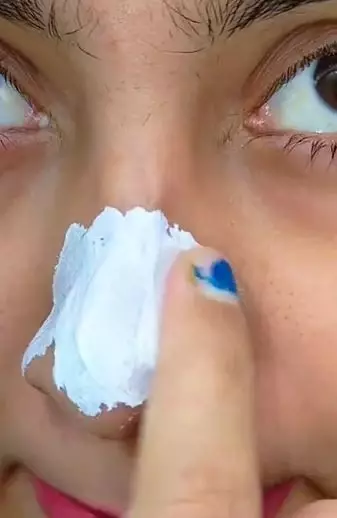 Atasi komedo di hidung pakai lemon pasta gigi TikTok Atasi komedo di hidung pakai lemon pasta gigi TikTok