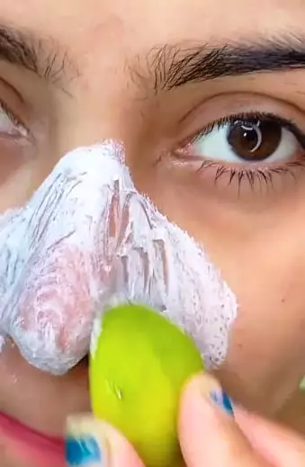 Atasi komedo di hidung pakai lemon pasta gigi TikTok Atasi komedo di hidung pakai lemon pasta gigi TikTok