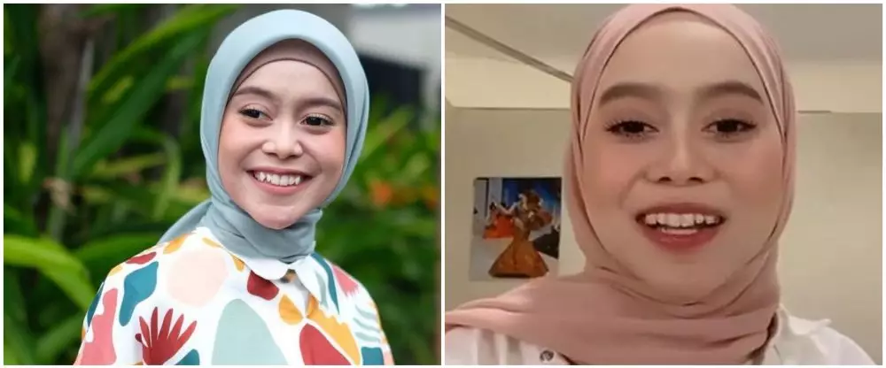 Seleb sebelum dan sesudah hilangkan gigi gingsul berbagai sumber Seleb sebelum dan sesudah hilangkan gigi gingsul berbagai sumber