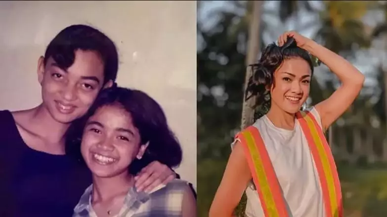 Seleb sebelum dan sesudah hilangkan gigi gingsul berbagai sumber Seleb sebelum dan sesudah hilangkan gigi gingsul berbagai sumber