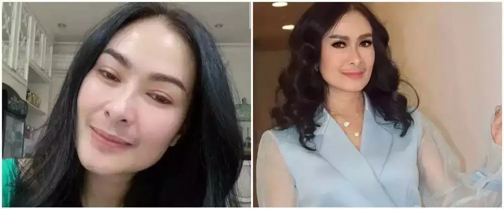 seleb usia 45 tahun suntik botoks Berbagai sumber