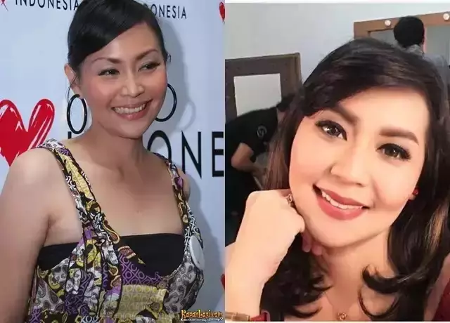 seleb usia 45 tahun suntik botoks Berbagai sumber