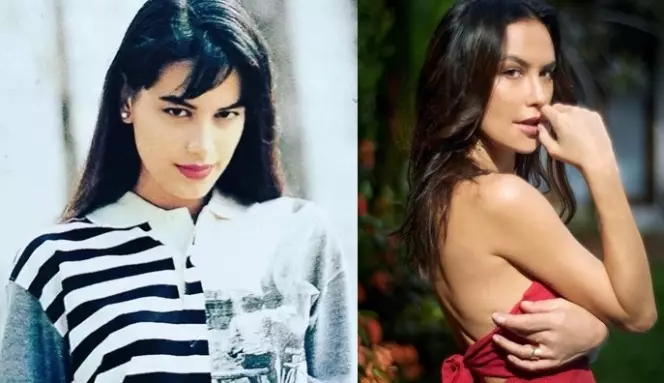 seleb usia 45 tahun suntik botoks Berbagai sumber