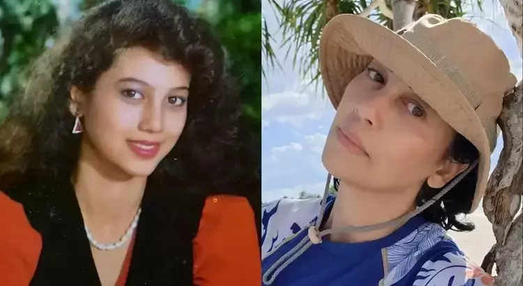 seleb usia 45 tahun suntik botoks Berbagai sumber