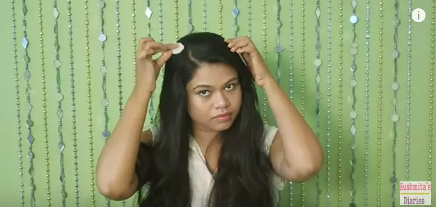 wanita ini bagikan cara atasi rambut botak berbagai sumber wanita ini bagikan cara atasi rambut botak berbagai sumber