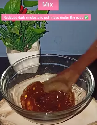 cara mengatasi kantung mata berbagai sumber