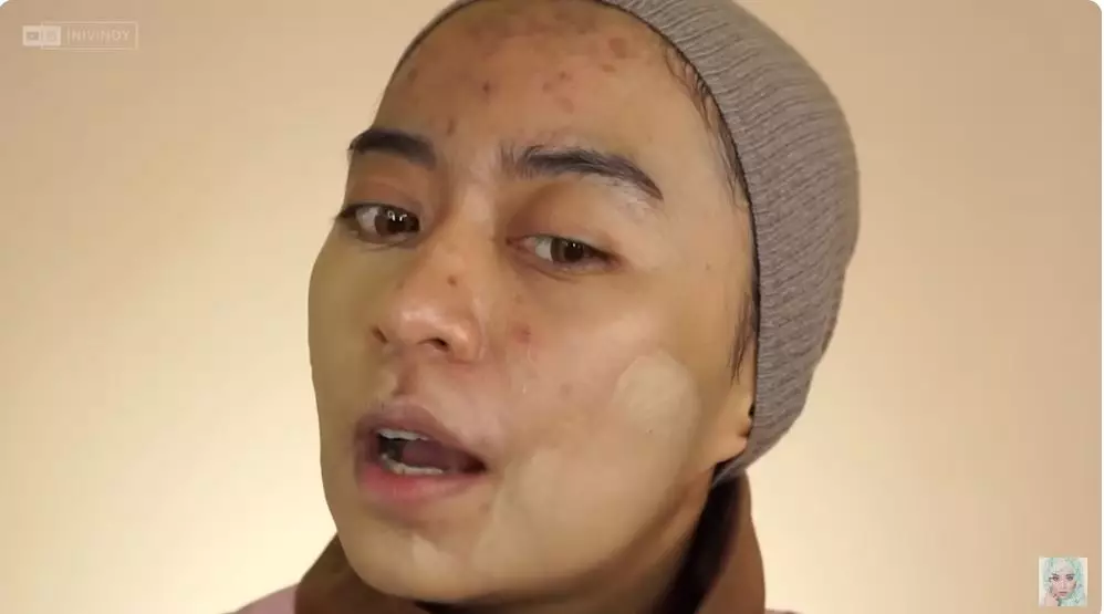 sulap wajah wanita penuh jerawat jadi flawless berbagai sumber