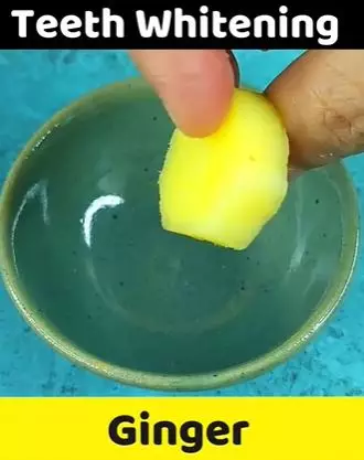 Atasi gigi kuning agar kembali putih cemerlang TikTok Atasi gigi kuning agar kembali putih cemerlang TikTok