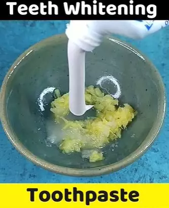 Atasi gigi kuning agar kembali putih cemerlang TikTok Atasi gigi kuning agar kembali putih cemerlang TikTok