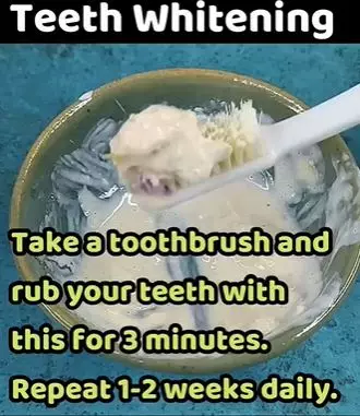 Atasi gigi kuning agar kembali putih cemerlang TikTok Atasi gigi kuning agar kembali putih cemerlang TikTok