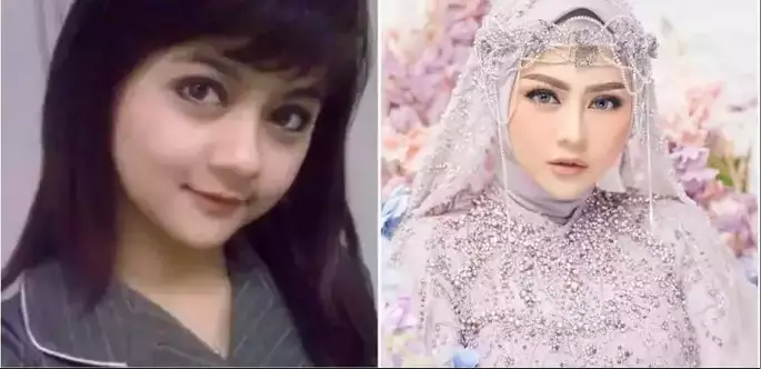 Sebelum dan sesudah tanam benang berbagai sumber Sebelum dan sesudah tanam benang berbagai sumber