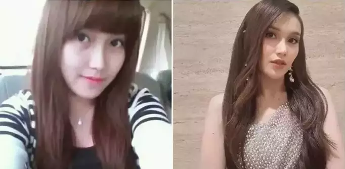 Sebelum dan sesudah tanam benang berbagai sumber Sebelum dan sesudah tanam benang berbagai sumber