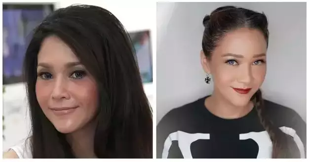 Sebelum dan sesudah tanam benang berbagai sumber Sebelum dan sesudah tanam benang berbagai sumber