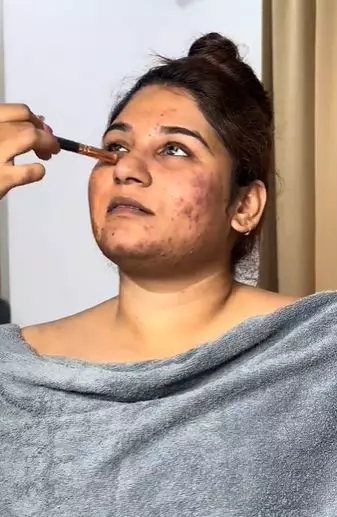 Wanita wajah berjerawat dirias bak ratu India TikTok Wanita wajah berjerawat dirias bak ratu India TikTok