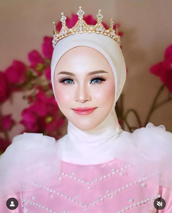 transformasi bos skincare Erlyanie Instagram