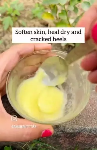4 bahan atasi tumit kaki kering dan pecah-pecah TikTok 4 bahan atasi tumit kaki kering dan pecah-pecah TikTok