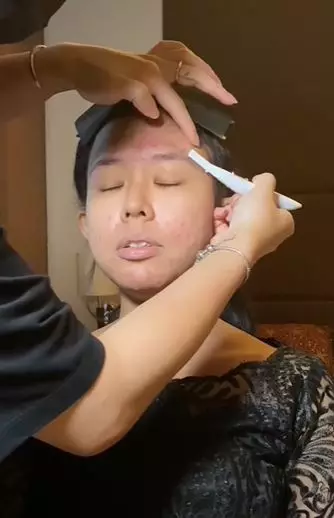 Transformasi makeup wajah jerawat meradang fresh makeup TikTok Transformasi makeup wajah jerawat meradang fresh makeup TikTok