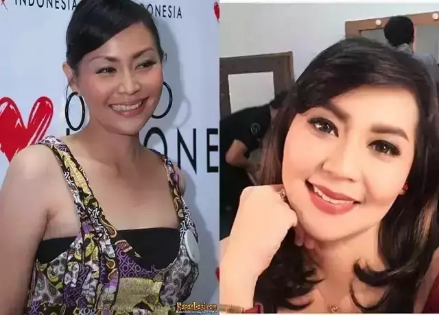 21 Seleb sebelum dan sesudah suntik botoks Berbagai sumber 21 Seleb sebelum dan sesudah suntik botoks Berbagai sumber