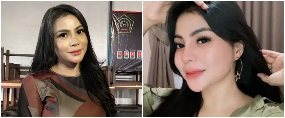 21 Seleb sebelum dan sesudah suntik botoks Berbagai sumber 21 Seleb sebelum dan sesudah suntik botoks Berbagai sumber