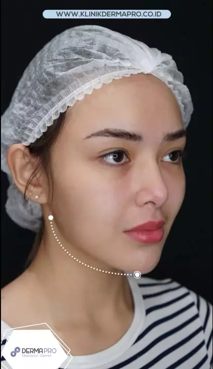 Amanda Manopo jalani tanam benang © Instagram Amanda Manopo jalani tanam benang © Instagram