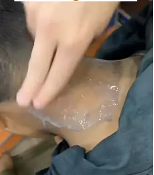 cara hilangkan daki di leher berbagai sumber