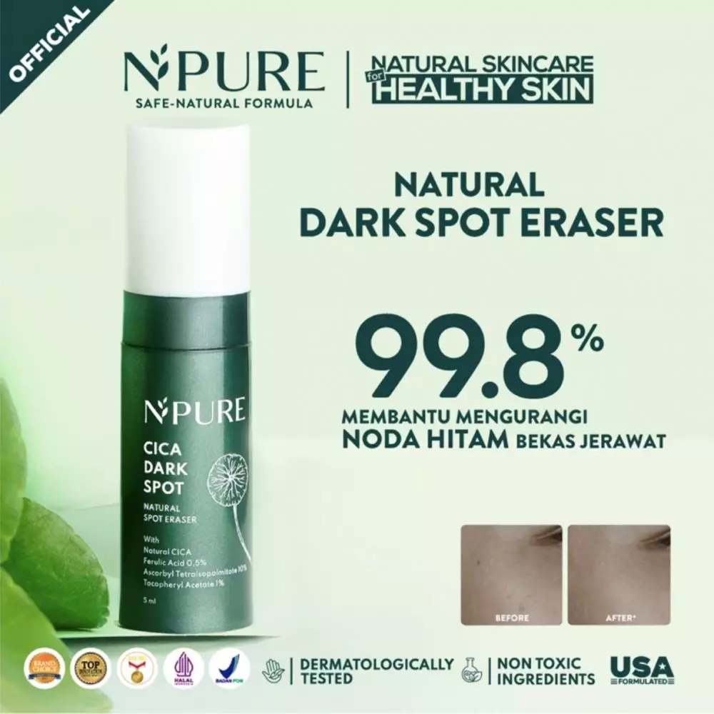 10 Rekomendasi skincare untuk mengatasi flek hitam harga di bawah Rp 200 ribu © 2024 berbagai sumber 10 Rekomendasi skincare untuk mengatasi flek hitam harga di bawah Rp 200 ribu © 2024 berbagai sumber