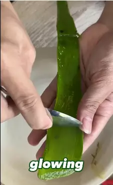 trik hilangkan jerawat ala rekomendasi dokter berbagai sumber