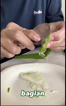 trik hilangkan jerawat ala rekomendasi dokter berbagai sumber